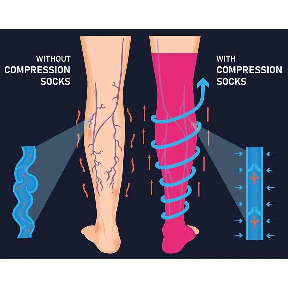 3 pairs of women's compression socks men's outdoor sports socks pregnant women's varicose vein socks